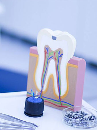 endodontic surgery